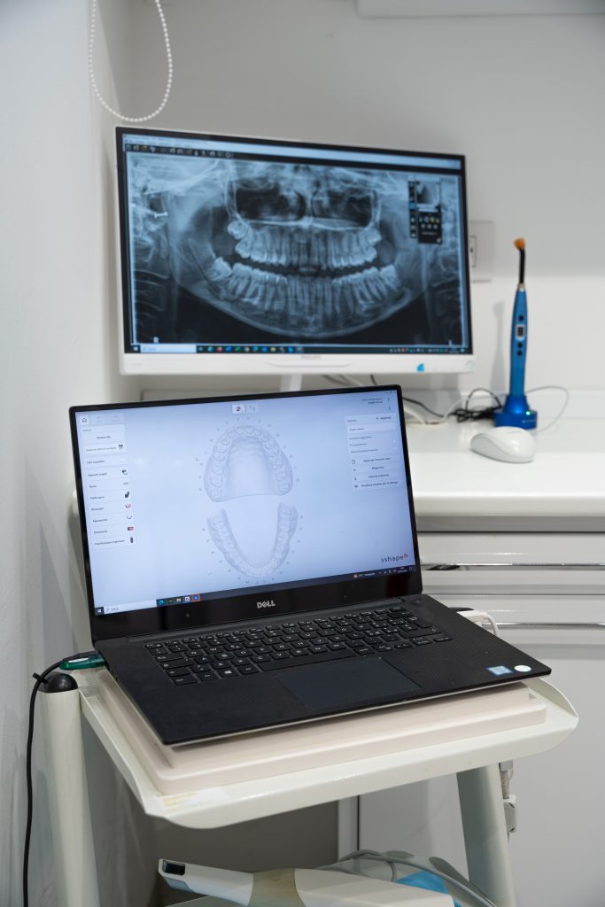 scanner 3d borgomanero, tecnologie odontoiatriche borgomanero dental feel